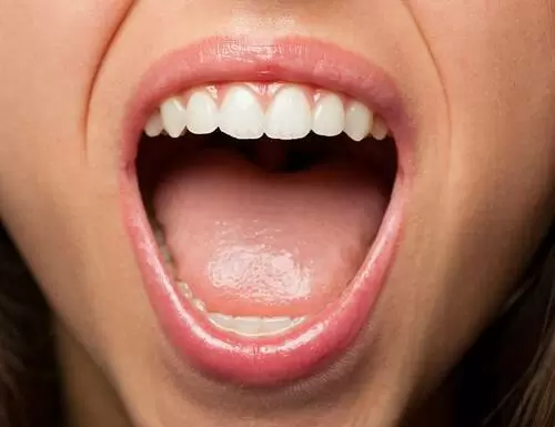 ¿Es normal tener la lengua blanca?