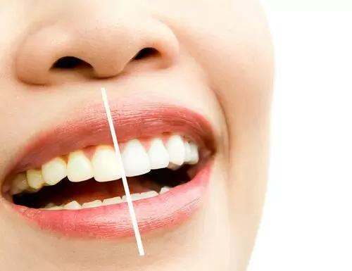 Cómo mantener los dientes blancos