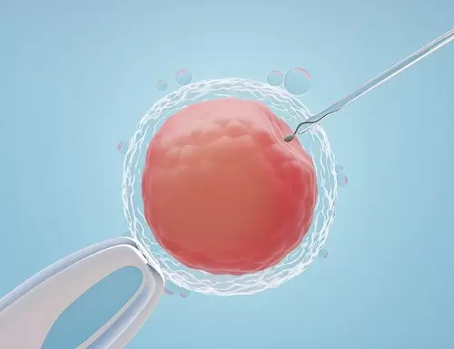 ¿En qué consiste la inseminación artificial?
