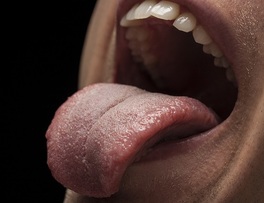 ¿Cómo calmar quemaduras en la lengua?